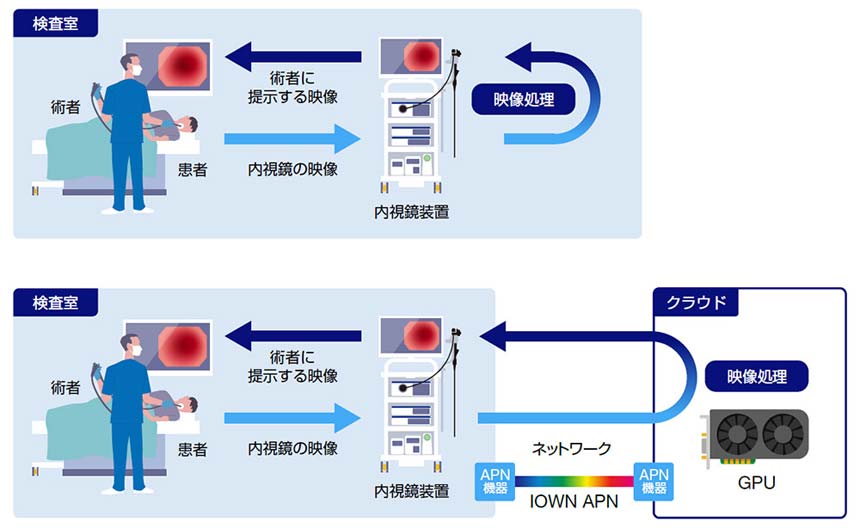 IOWN APNを活用した内視鏡システムのクラウド化へ NTTとオリンパスが共同実証