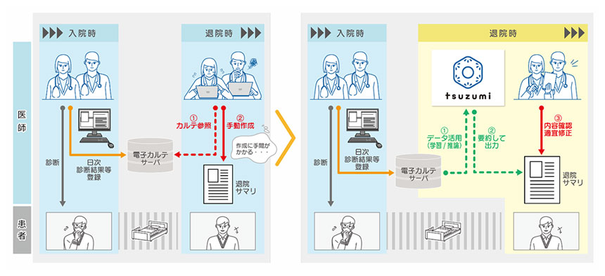 三重大学とNTT西、NTT版LLM「tsuzumi」による電子カルテ要約の実証実験