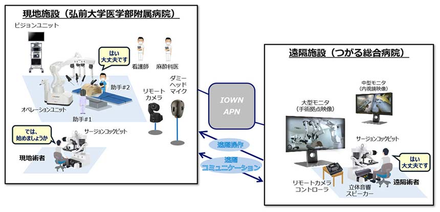 APNを活用した遠隔手術支援の構成イメージ