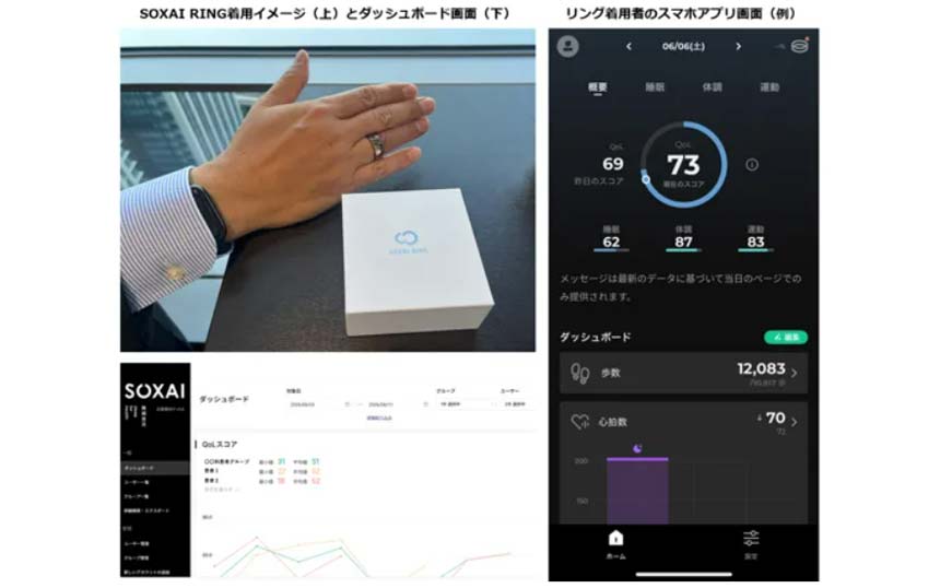 ドコモビジネスと竹田健康財団、スマートリングを活用した術後患者の経過観察に関する実証